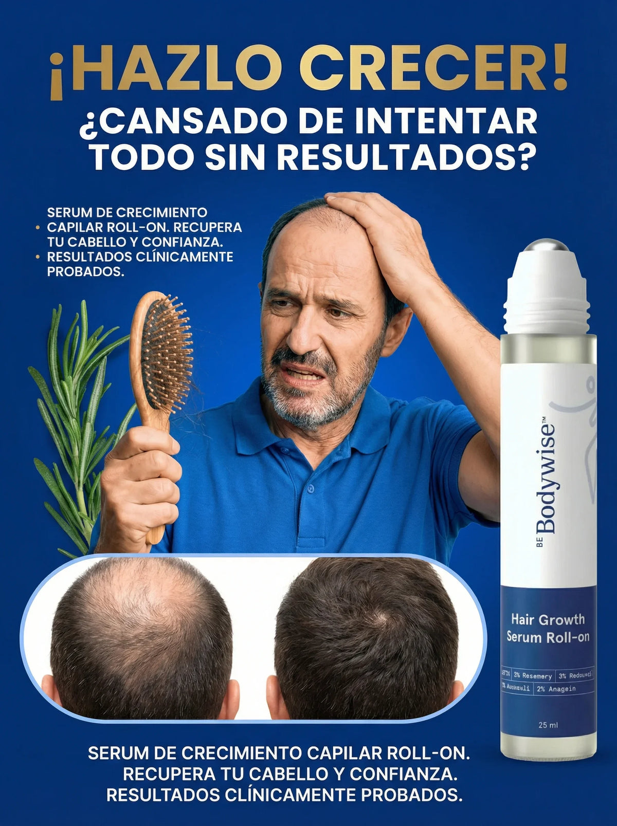 BODYWISE - SUERO PARA EL CRECIMIENTO CAPILAR 👨🏻🦲👩🏻🦱✨