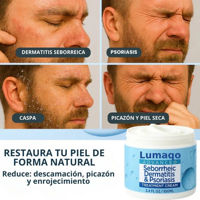 Tratamiento Para El Alivio de la Dermatitis Seborreica y Psoriasis