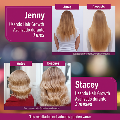 Hair Growth - Vitaminas Avanzadas Para el Cabello 👩🏻✨