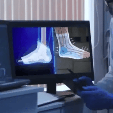 Medias De Compresión / Neuropatía - Obtén Alivio Instantáneo De Pies Hinchados Y Adoloridos